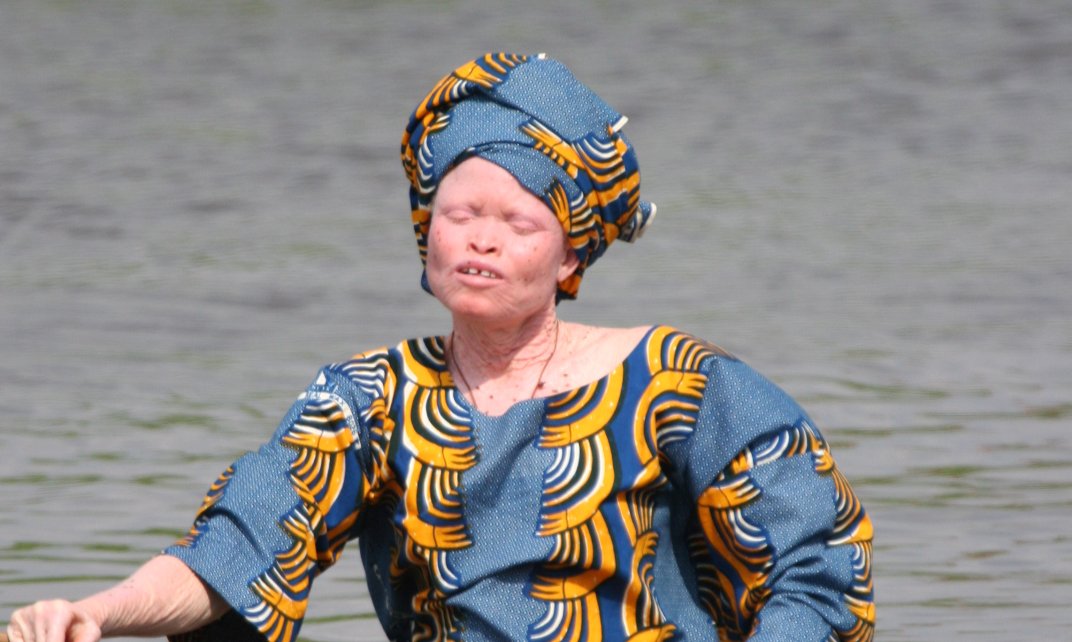 Vrouw met albinisme roeit in een bootje