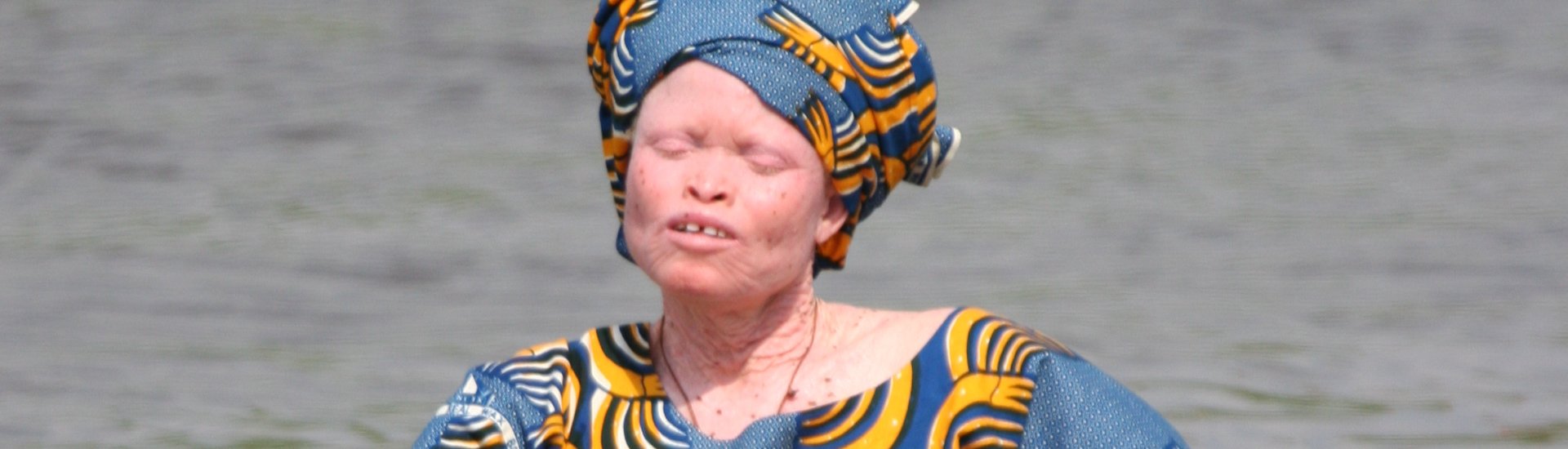 Vrouw met albinisme roeit in een bootje